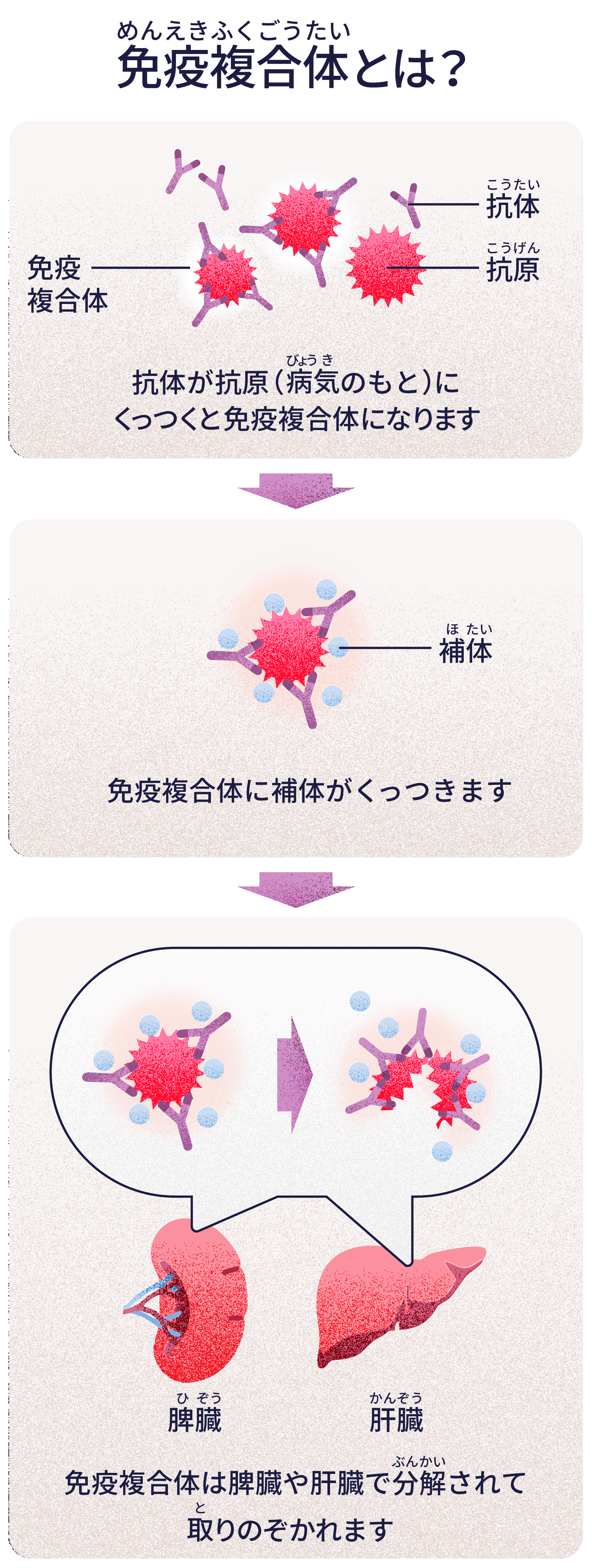 免疫複合体とは？