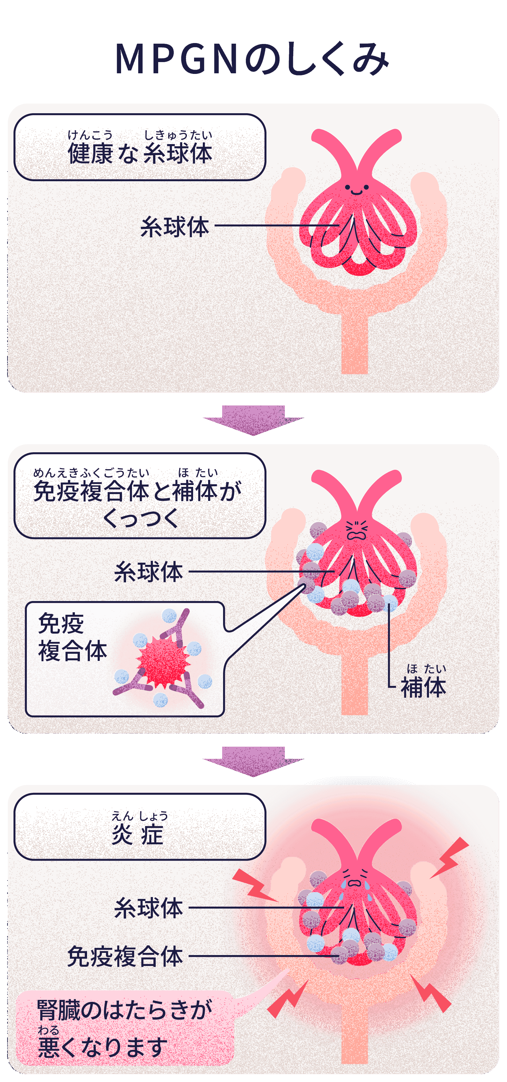 MPGNのしくみ