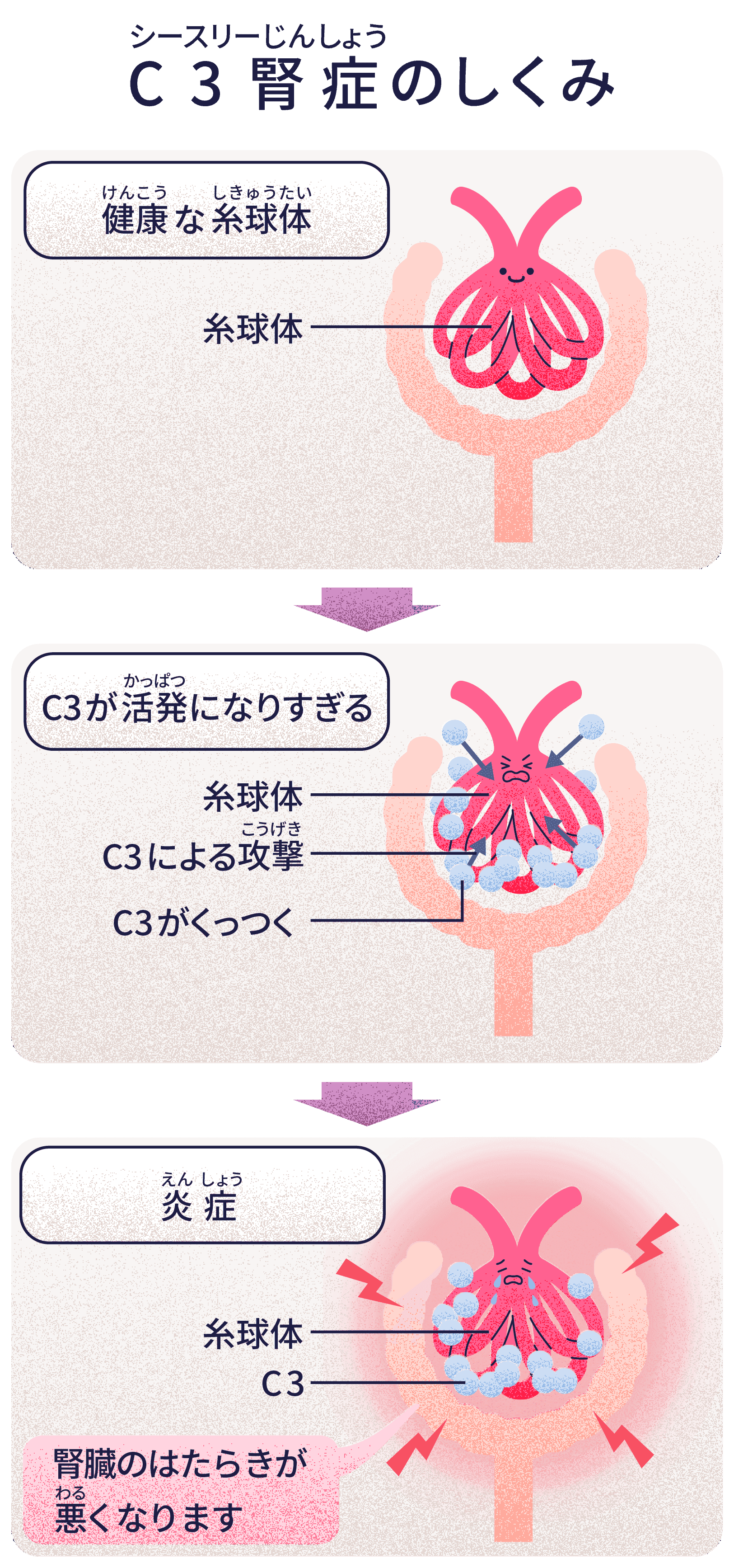 C3腎症のしくみ