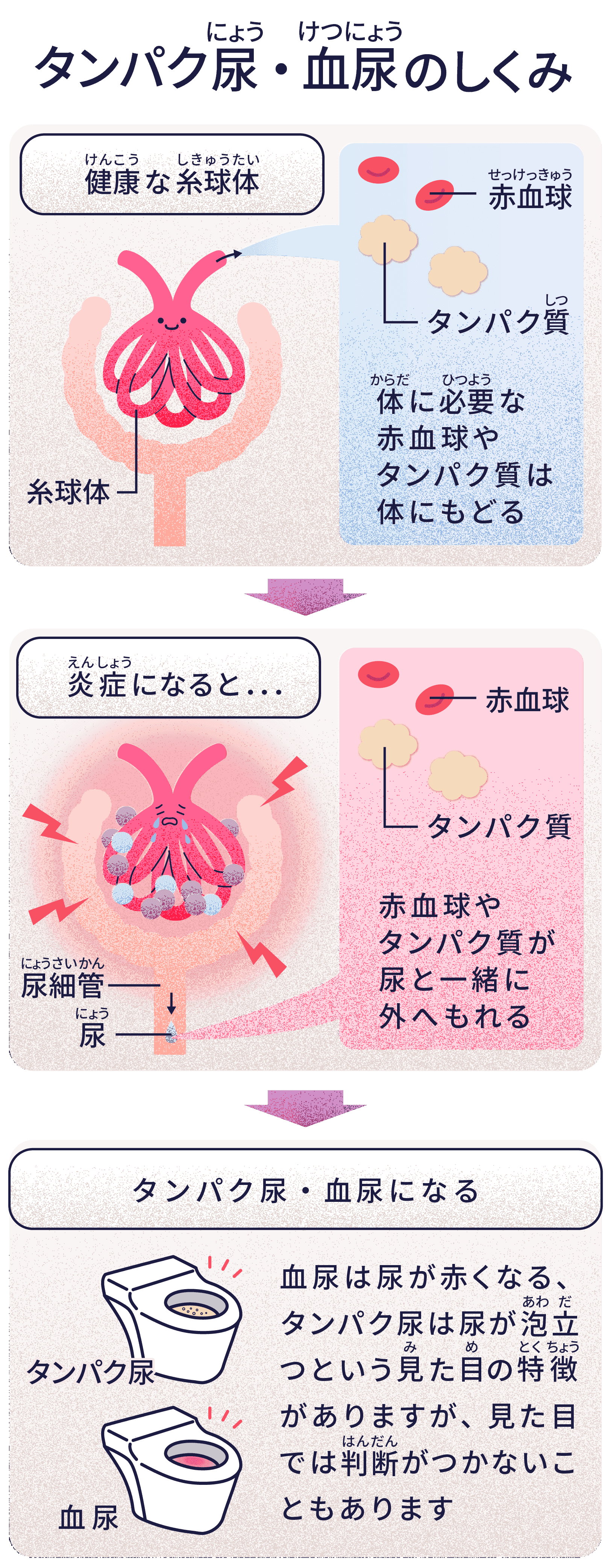 タンパク尿・血尿のしくみ