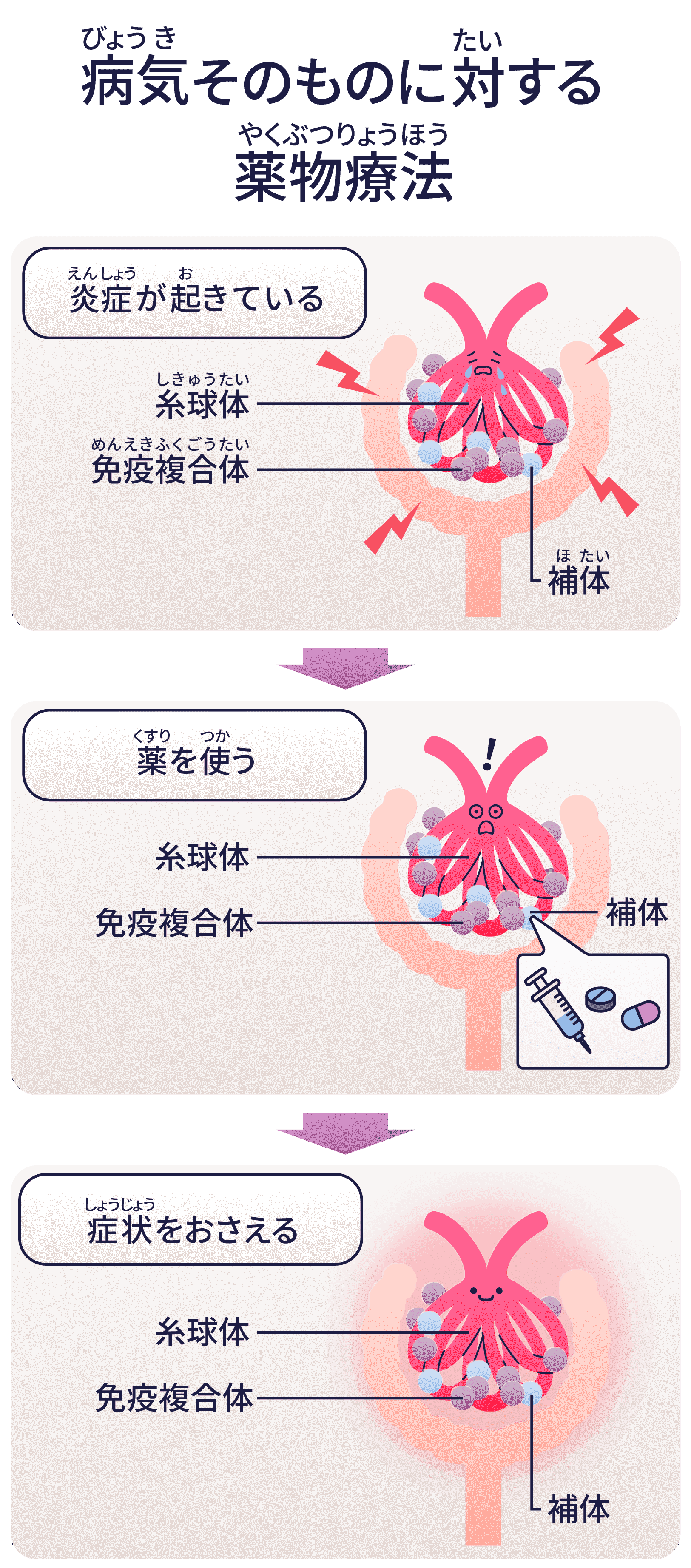 病気の進行を食い止める薬物療法